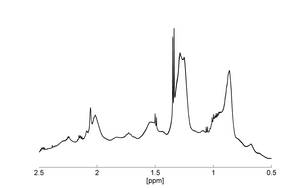 Overlay of 6 spectra each prepared and measured independantly on aliquots of a serum sample at Bruker BioSpin Rheinstetten and at Leiden University Medical Center in Holland, showing absolute identity of all spectra.