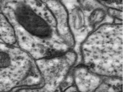 Rat hippocampus zoom images from a single tile of 24 k × 24 k pixels.