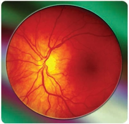 Ophthalmoscopic Image of Retinal Tissues