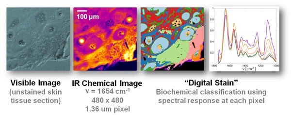 Spero enables label-free, high-resolution chemical imaging and identification of a wide range of materials and biomaterials including cells, tissues, and biofluids. The above example shows from left to right a visible image of an unstained skin tissue section, a high-definition IR chemical image collected on the Spero microscope of the same region, and a digitally stained image whereby the spectral response of each pixel is grouped into 1 of 10 spectral classes shown in the rightmost plot.