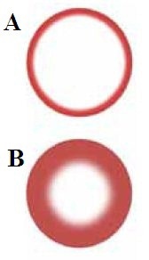 (a) High frequency induction heating has a shallow skin effect which is more efficient for small parts; (b) Low frequency induction heating has a deeper skin effect which is more efficient for larger parts.