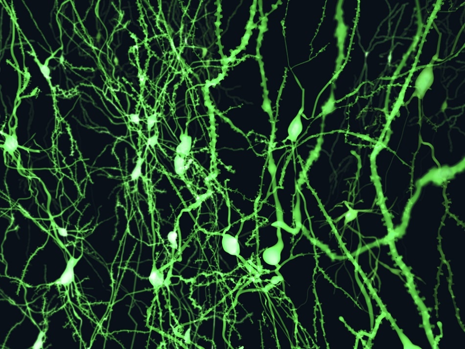 Cortical neurons marked with a fluorescent dye.