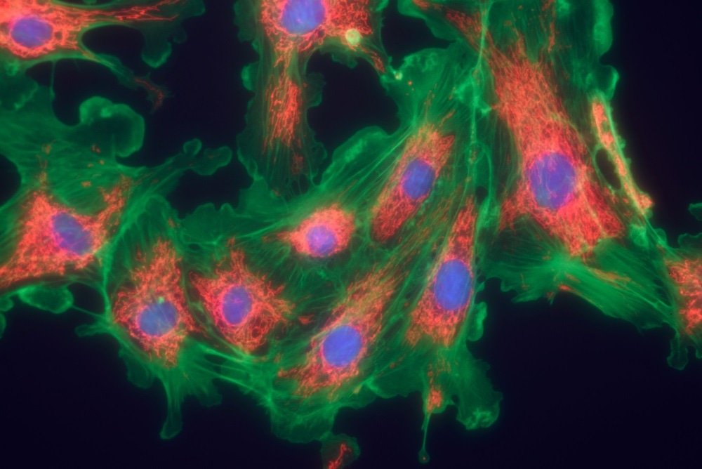 Fluorescence spectroscopy allows cellular features such as microfilaments, mitochondria, and nuclei to be observed.