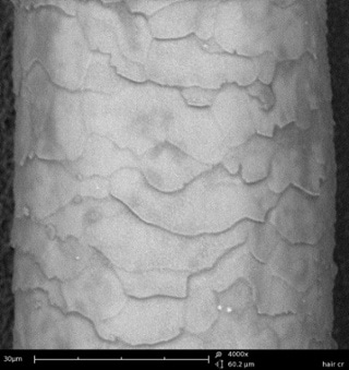 SEM images of a human hair imaged in high vacuum (top) where charging is visible and in low vacuum (bottom), using the charged reduction sample holder.