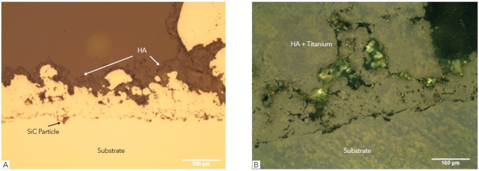 Showing (A) as polished surface bright field image showing the Ti6Al4V substrate and thermal sprayed titanium and hydroxyapatite (HA) top coat, (B) as-polished viewed with polarized light to reveal the alloy and sprayed titanium microstructures.