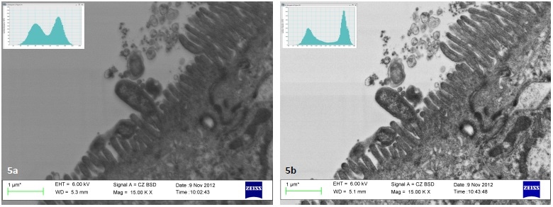 Analysis of images in Joubert [5] indicates a 15% increase in contrast of thin sections of Helicobacter pylori on cACO-2 cells after plasma cleaning.