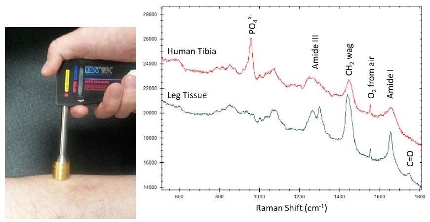 Transcutaneously collected STRam spectra of human tibia and leg tissue.