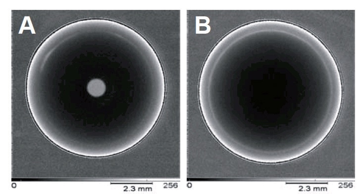 Transmission x-ray images of two cultured pearls, (A) high quality freshwater pearl from China, and (B) seawater pearl from Tahiti.