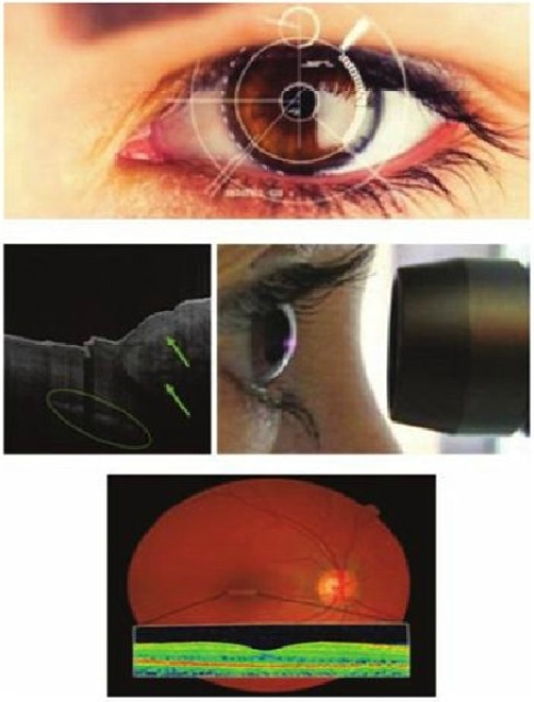 OctoPlus provides users with accurate images, for example, of the retina and cornea; mapping tissue structures, measuring thickness, and visualizing blood flow dynamics for diagnostics.