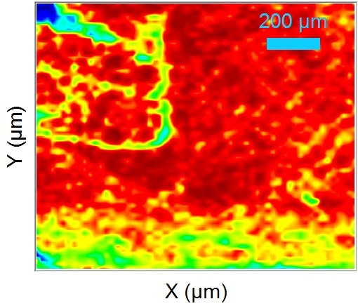 Raman image of the trans-configuration distribution of a 1200 x 1200 µm bovine adipose tissue sample, using a 785 nm excitation.