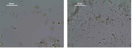 Cells of the diatom Thalassiosira pseudonana before (left) and after disruption (right) using the Mixer Mill MM 400 in combination with the tube adapter for 50 mL tubes; 20 seconds at 20 Hz.