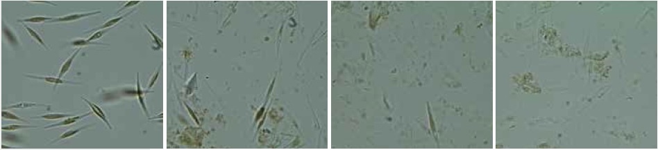 Cells of Phaeodactylum tricornutum before (left) and after cell disruption (middle and right) with the Mixer Mill MM 400 in combination with the adapter for conical centrifuge tubes; 3 x 60 seconds at 30 Hz.