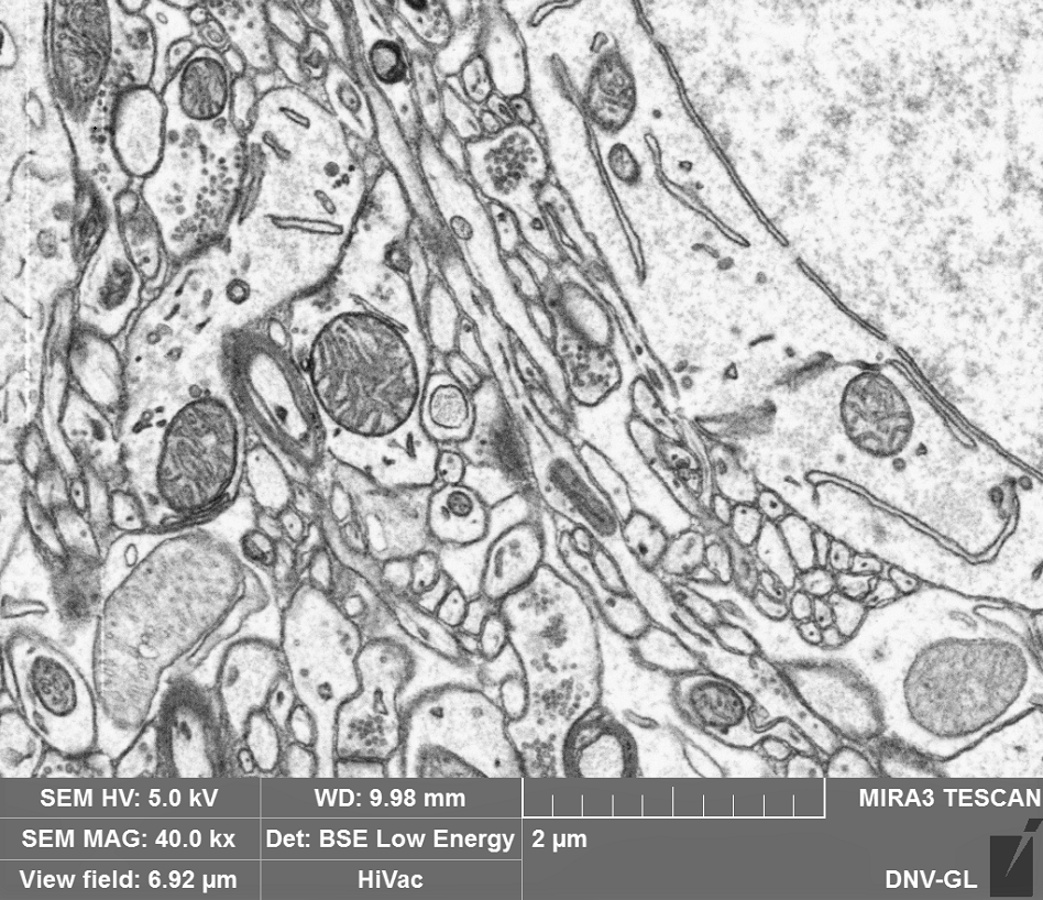 Low Energy BSE Detector Image of biological cells from thin section picked up on tape. Note the signal has been inverted so as to match typical TEM images