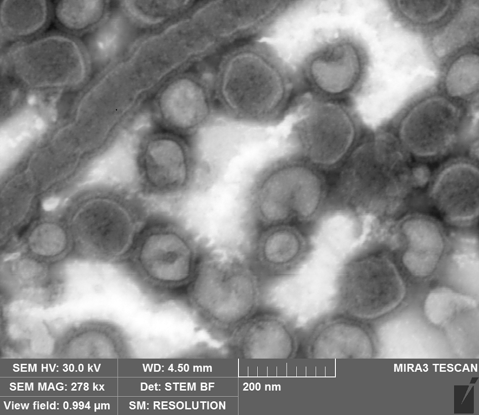 Negatively stained Influenza Virus, usually spherical or ovoid in shape, 80 to 150 nm in diameter, with glycoprotein spikes, imaged using the STEM detector
