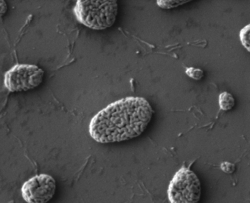 SEM image to show the morphology of Au nanoparticles