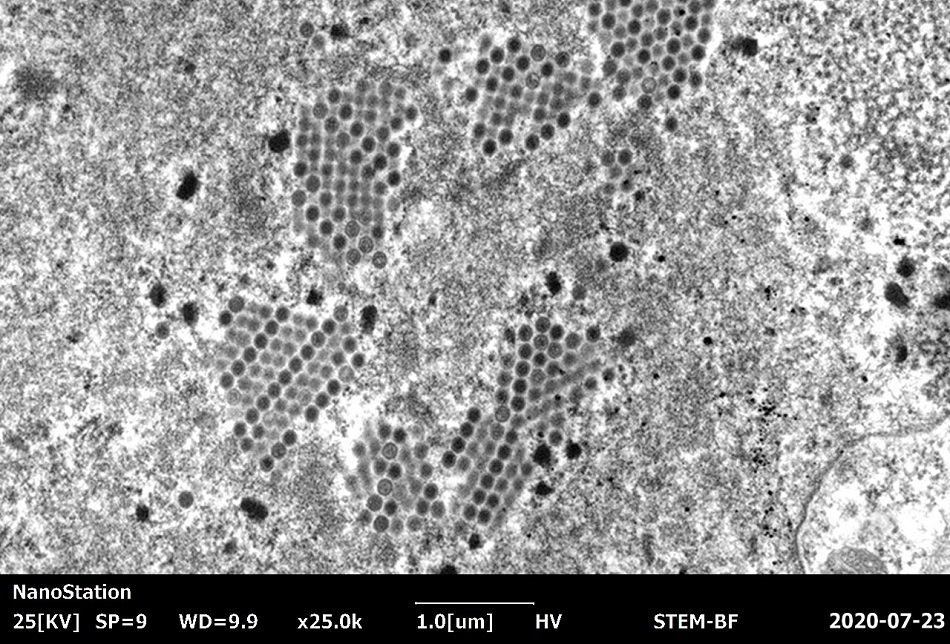 Adenovirus imaged at 25,000 X