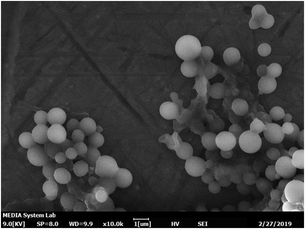 Microplastic particles separated from sea water and imaged on a Coxem EM-30AXPlus tabletop SEM.