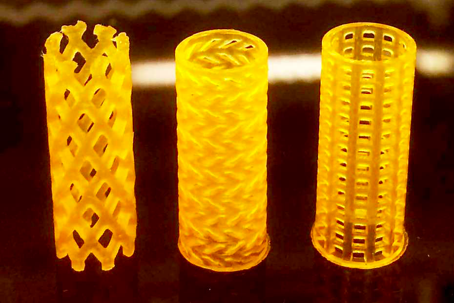 The researchers developed three different 3D printed stent designs