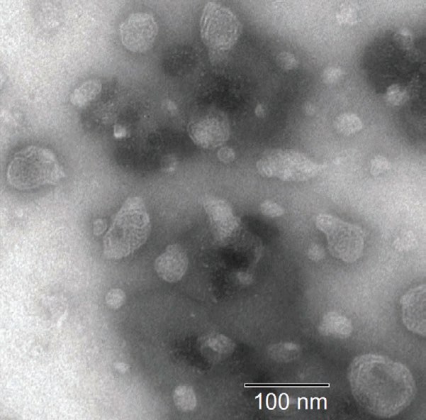 DLS and SEM results for liquid crystalline nanoparticles