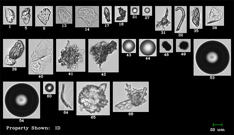 Intrinsic and extrinsic particles imaged by the FlowCam: protein aggregates, glass shards, silicone oil droplets, and other particulate.
