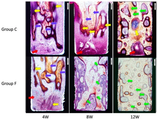 Microscopic images of inner surfaces of the slits under natural light. Yellow arrows indicate fibrous osteoids, blue arrows are fibrous bones, red arrows are fibroblasts, and greenish-yellow arrows indicate lamellar bones.