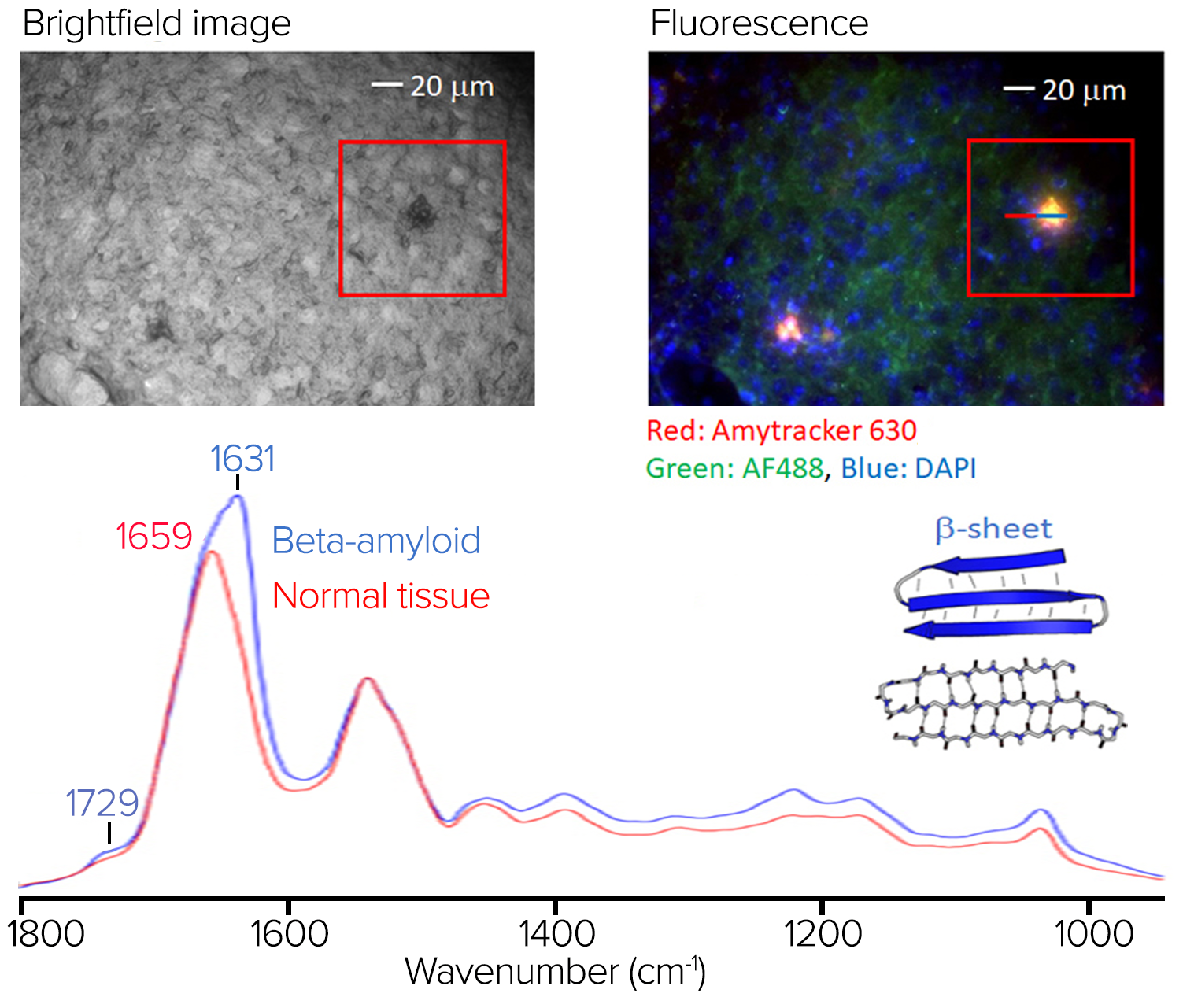 Stained tissue sample with fluorescence image and spectra showing significant spectral differences at 1631cm-1.