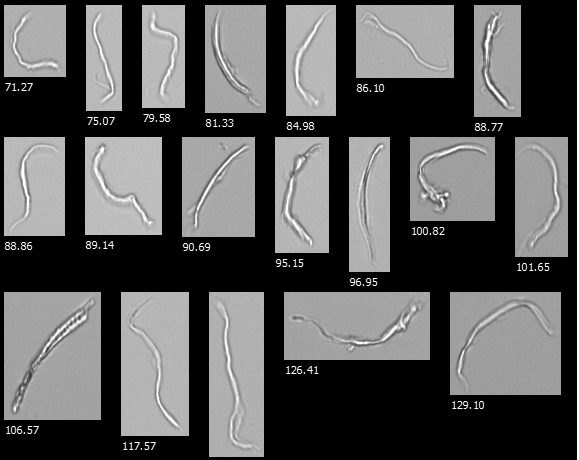 FlowCam images from a cellulose microfibril sample