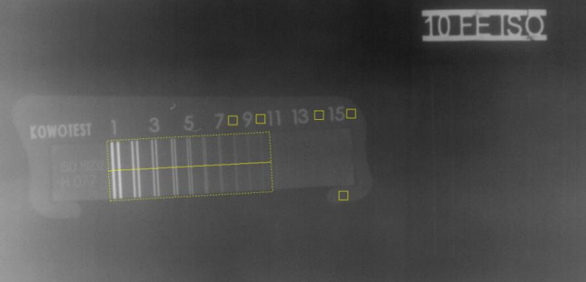 Cropped digital X-ray image from D-Tect software showing the areas of measurement.