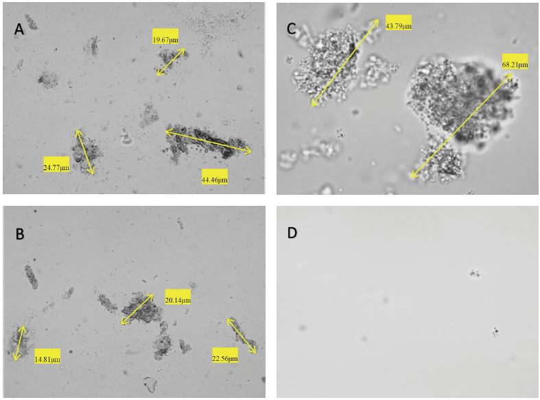 Examples of the microscopic results from BeVision S1. A&B: Results of unhomogenized soy milk under 10x objective. C: Zoom-in results with oversized particles of unhomogenized soy milk under 40x objective. D: Results of homogenized soy milk under 40x objective.