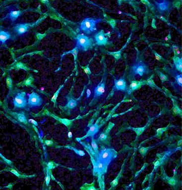 Digitally enhanced microscope image of neural stem cells (shown in green and blue) grown within a protein-engineered biomaterial. Several of the cells have started to differentiate into neurons (shown in green) and to extend long neuritic sprouts.