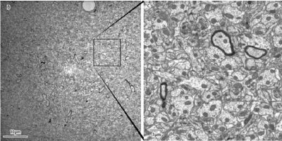 (B) A single 49 µm STEM-in-SEM image, acquired at 2 nm per pixel. The inset square illustrates the comparative size of a TEM image acquired on a 4 k x 4 k camera, also at 2 nm per pixel.(C) Detail from an approximately 9 µm x 9 µm region of Image B. Note the image quality is comparable to results obtained by conventional TEM. At full resolution, key organelles are readily resolved including (D) post synaptic densities at synapses, (E) polyribosomes and (F) crosssectioned microtubules suitable for serial tracing and dense reconstruction. Results courtesy of John Mendenhall, Center for Learning and Memory, University of Texas at Austin.
