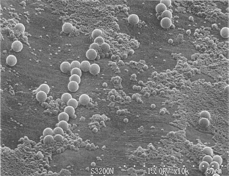 An electron microscopic image of the sample in Figure 5.