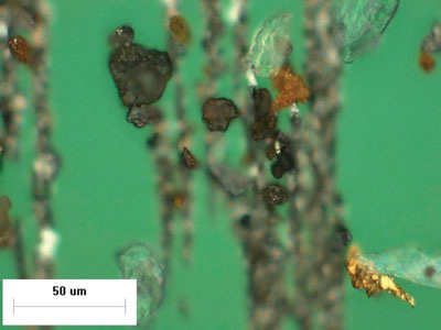Ferrogram image showing dark metallo-oxides indicative of abnormal wear