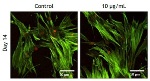 Stem Cell Applications of Nanohydroxyapatite