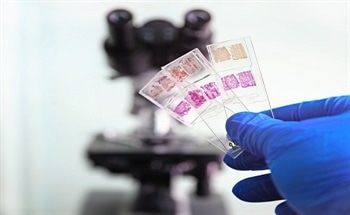 Technique for the Transfer of Tissue or Cytology Samples from Standard Slides to Positively Charged Slides