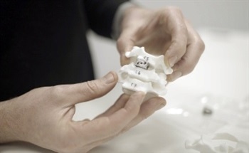 Creating Spinal Implants Using Additive Manufacturing