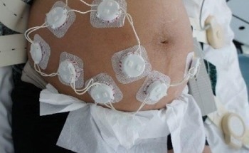 An Electronic Fetal Monitoring System: From Astronauts to Fetuses in Utero