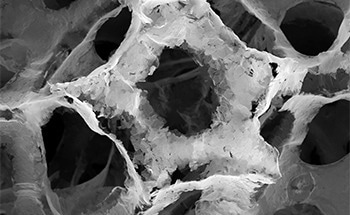How to Look Inside Nanoporous Metals for Catalysts