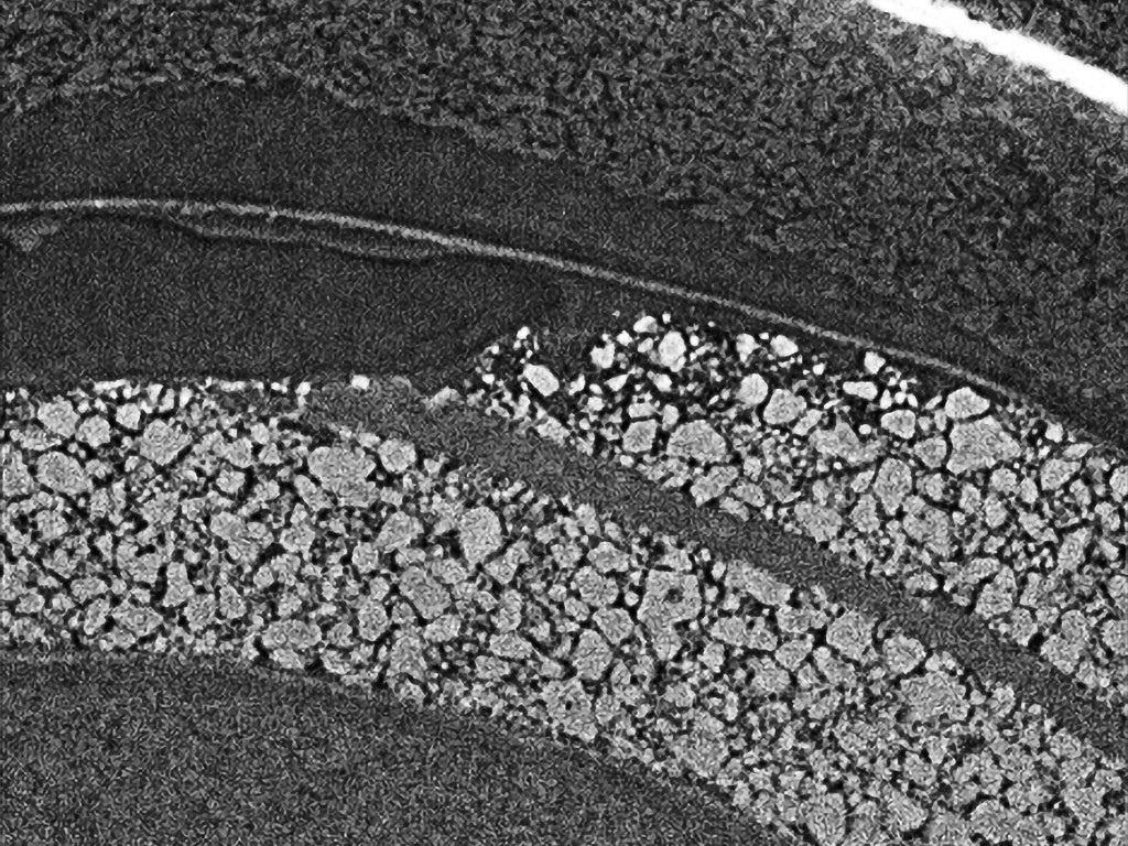 Small pouch cell (80 kV)—in situ microstructure, aging effect at cathode grain level, separator layer.