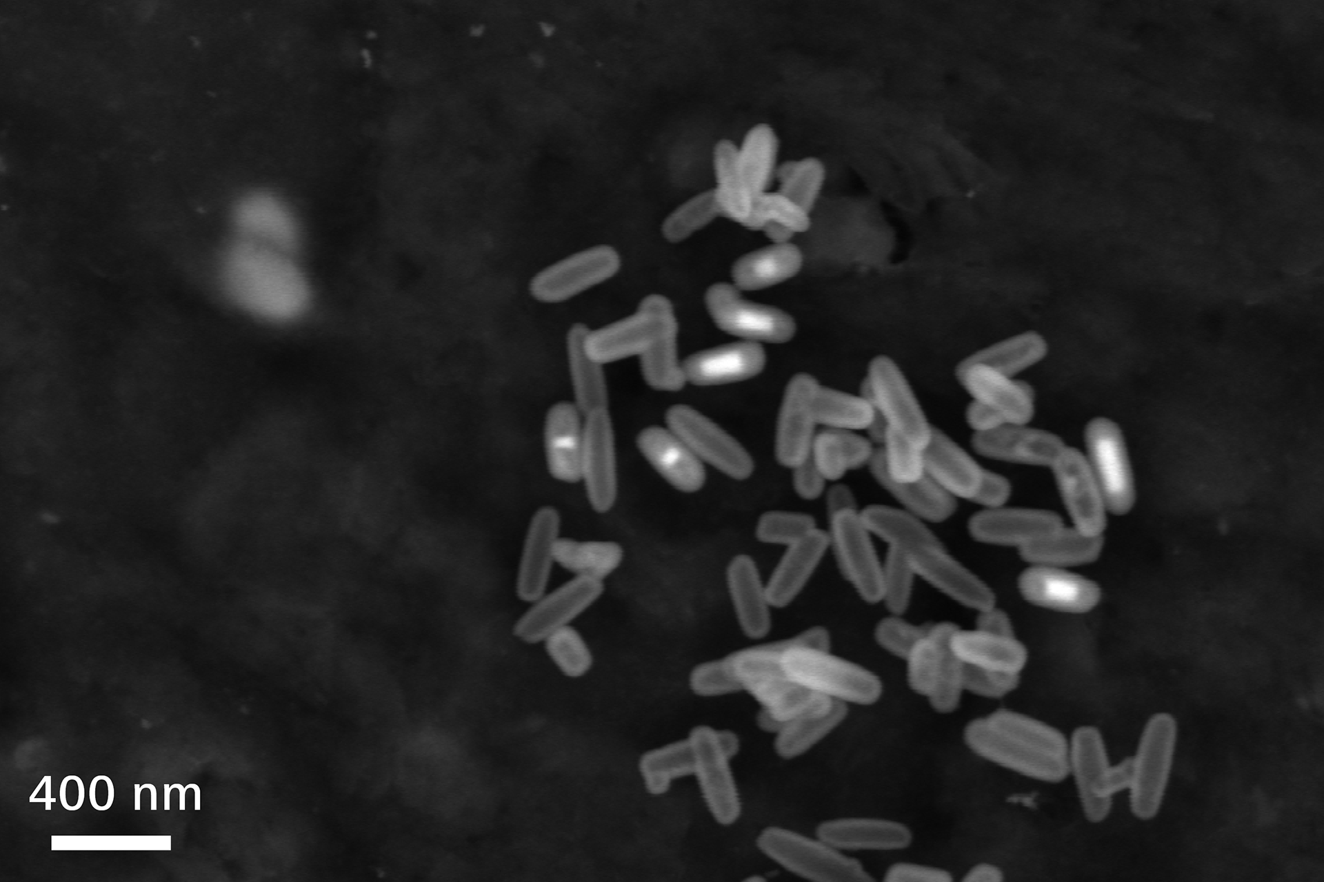 MSC capsules (hollow mesoporous silica) for drug delivery. Backscatter imaging reveals iron oxide core in silica-nanocapsules. Sigma 560, HDBSD, 5 kV.
