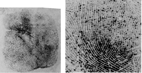 Left: 1,2 Indanedione palm print; illuminated at 535nm and captured using a BP600 camera filter. Right: Same Image on Left “Zoomed In”.