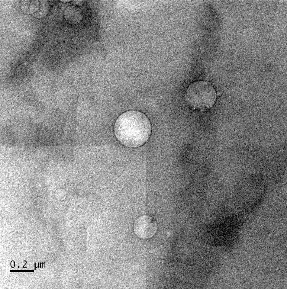 Low-salinity brine injected into crude oil forms nanoscale droplets that help separate oil from rock in reservoirs, according to Rice University engineers. The black ring around the droplets, seen in a cryogenic electron microscope image, is asphaltene.