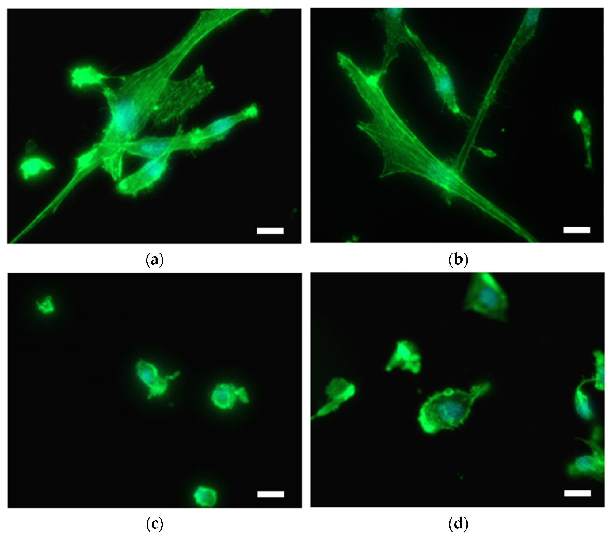 SMC on the surface of (a) Ti foil, (b) plasma-treated Ti foil (Ti + P), (c) hydrothermally treated Ti foil (Ti HT) and (d) hydrothermally/plasma-treated Ti foil (Ti HT + P), determined by immunofluorescent microscopy. F-actin is shown in green (Fluorescein Phalloidin). Nuclei are visualized with DAPI (blue color). Scale bar = 25 µm.