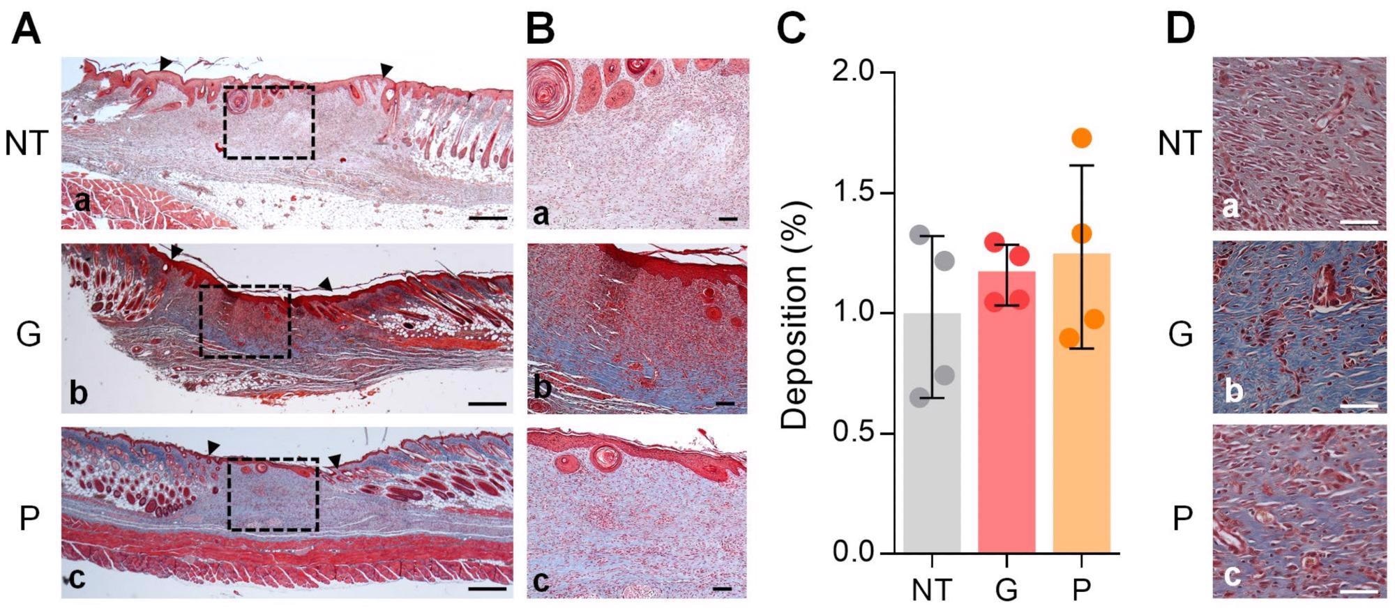 Analysis of collagen deposition in wound tissue. Histological analysis by Masson’s Trichrome is shown. (A,B) The whole wound at 2x magnification (A) and within the wound at 10x magnification (B) is shown for NT (a), gel (b), and powder (c) conditions. Black dashed rectangles demarcate the wound areas shown at higher magnification on the right. Black triangles indicate the wound edges, whereby the wound is located between these markings. Scale bars for (A,B) represent 500 µM and 100 µM, respectively. (C) The ratio of collagen deposition across the wound bed for all treatment groups is displayed. The results are expressed as mean ± standard deviation, n = 4 across all treatment groups. (D) The wounds at 40x magnification are shown for NT (a), gel (b), and powder (c) conditions. The scale bars represent 50 µM.