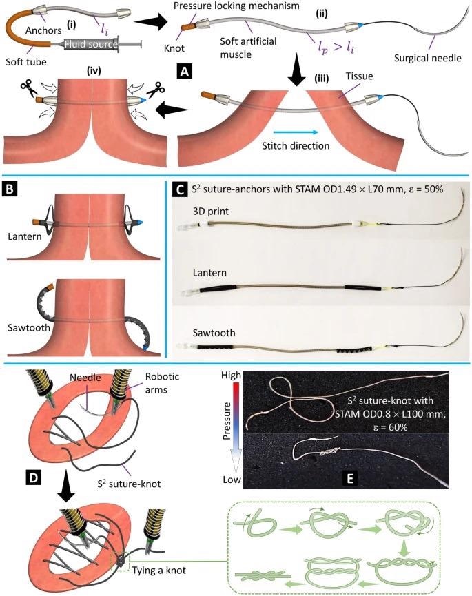 Fabrication, working concept, and prototypes. (A) (i) S2 suture-anchor with 3D printed anchors at the initial phase (no pressure). (ii) Completed S2 suture-anchor with pressurized artificial muscle. (iii) Making stitches through tissue. (iv) Tightening the suture and tissue by releasing pressure. (B) Deployment of the lantern and sawtooth anchors after releasing the pressure. (C) S2 suture-anchor prototypes made from STAM, three types of anchors, and commercial surgical needles (details in Table 1). (D) Wound closure procedure using dual surgical robotic arms with continuous stitches of the S2 suture-knot. (E) An S2 suture-knot prototype at high and low pressure.