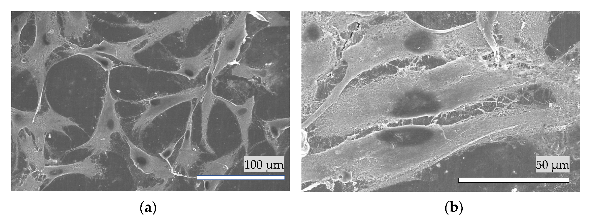 A typical SEM image of the HPdLF cells attached on the surface of (a) the hydroxyapatite coating and (b) bovine enamel.