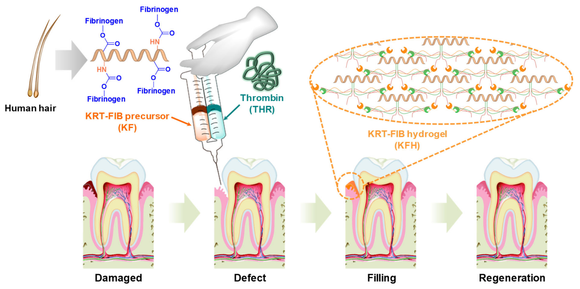 Schematic illustration of keratin-conjugated fibrinogen (KRT-FIB) hydrogels (KFHs) for oral tissue regeneration.