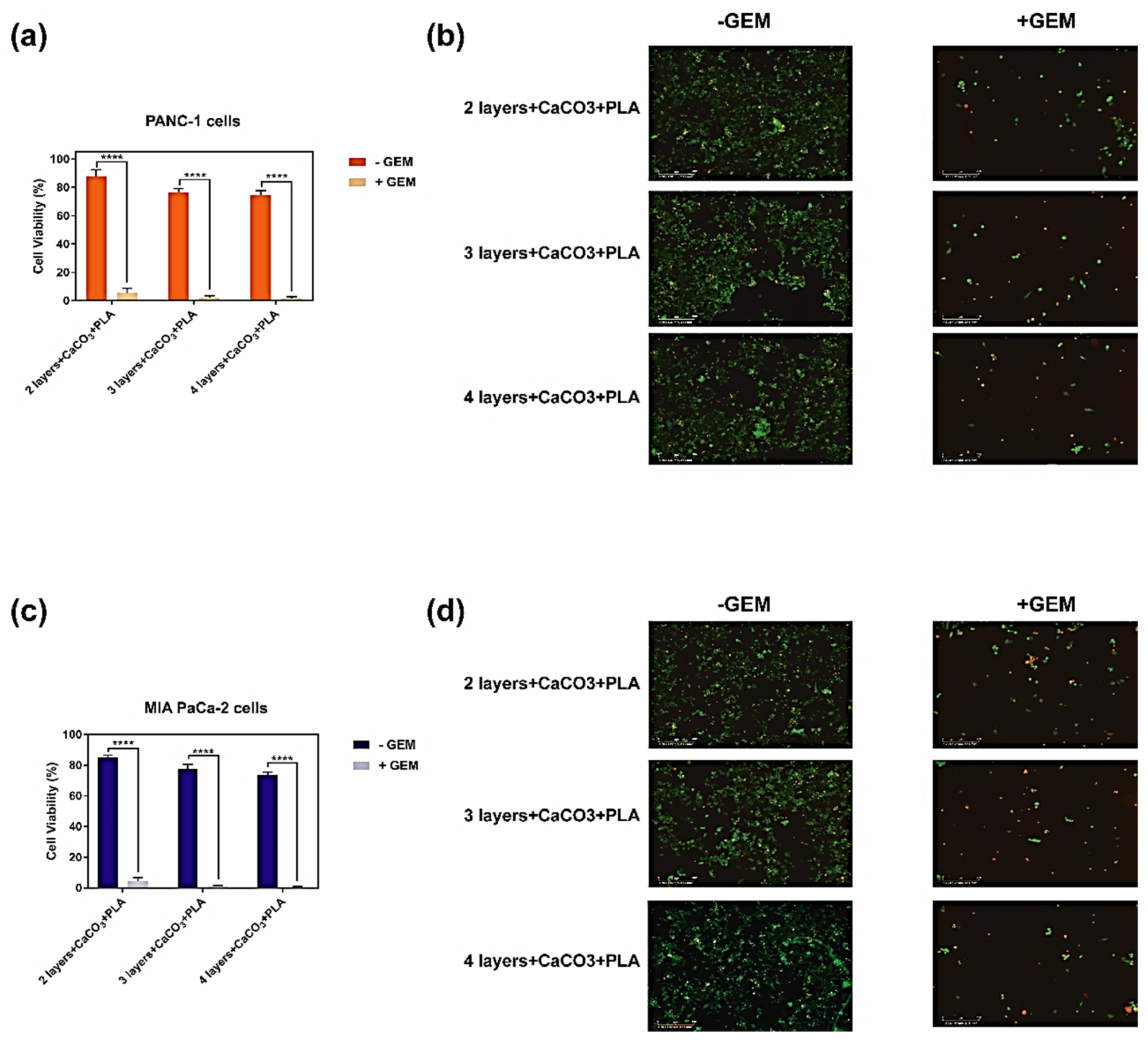 In vitro biocompatibility of PLA coated 3D printed coaxial patches containing CaCO3 either without Gemcitabine (- GEM), or loaded with Gemcitabine (+ GEM). (a) MTS cell viability assay of PANC-1 human pancreatic adenocarcinoma cells when treated with the patches for 72 h. (b) Corresponding live/dead cell staining of treated PANC-1 human pancreatic adenocarcinoma cells. (c) MTS cell viability assay of MIA-PaCa-2 human pancreatic adenocarcinoma cells when treated with the patches for 72 h. (d) Corresponding live/dead cell staining of treated MIA-PaCa-2 human pancreatic adenocarcinoma cells. Values are the mean (±SEM) of quadruplicate. **** p = 0.0001.