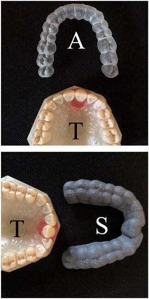 A custom-made typodont (T), a 4D-printed aligner (A), and a gray splint (S).