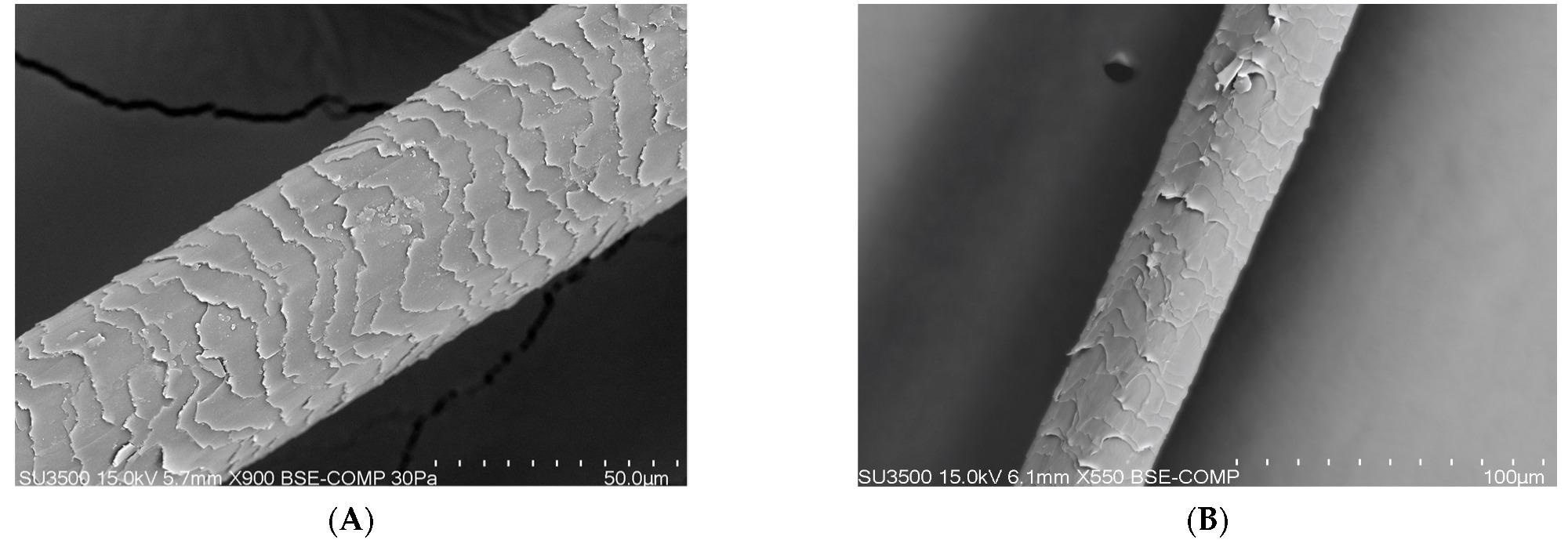 (A) Photo of the hair of proband A before the application of collagen laminate (50-micron × 900, 15 kilowatt-hours). (B) Photo of the hair of proband B before the application of collagen laminate (100-micron × 550, 15 kilowatt-hours).